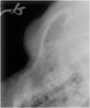 Sinus neoplasia in a 7yo FE Rottweiler