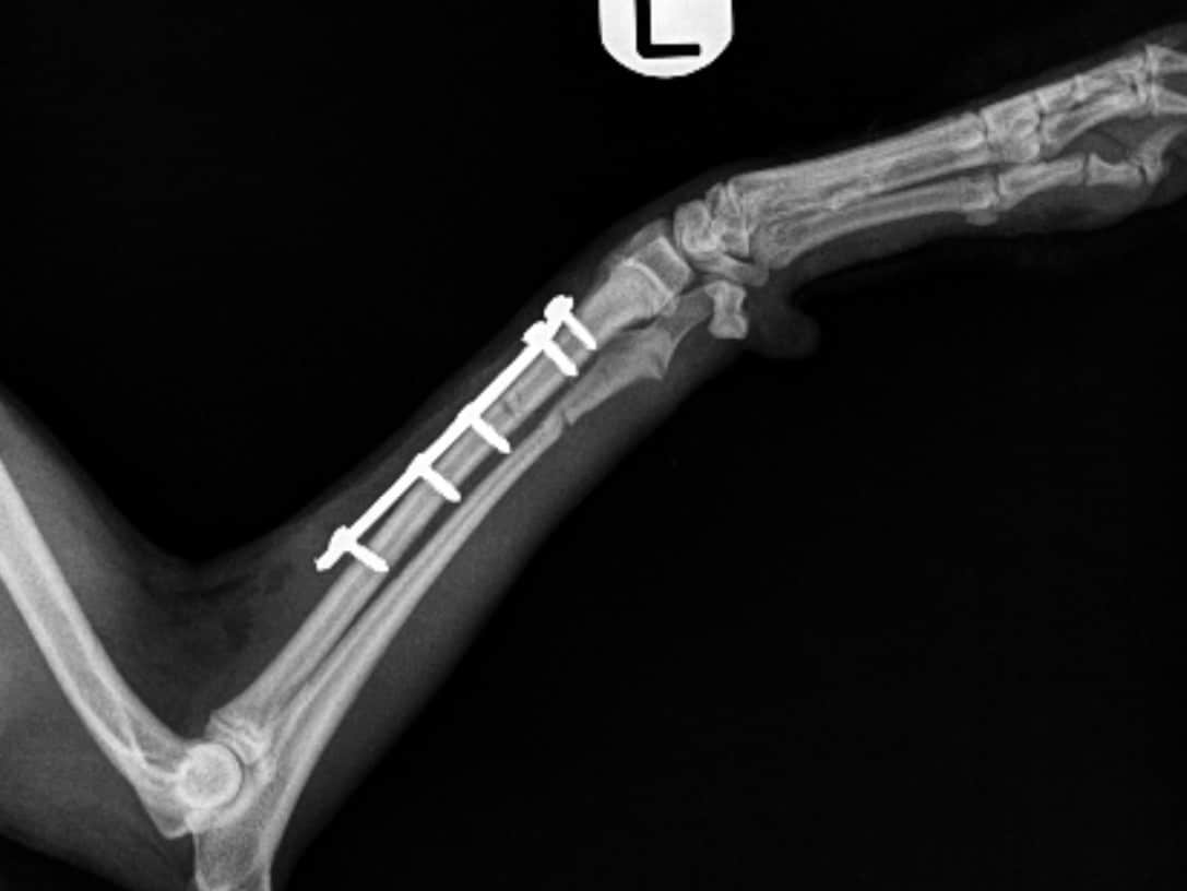 Fractured Leg Case Study Northwest Referrals
